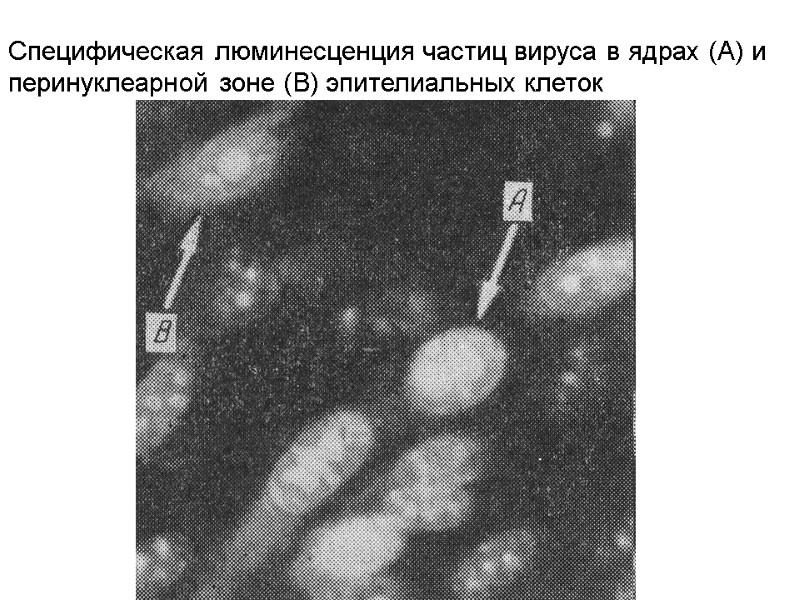 Специфическая люминесценция частиц вируса в ядрах (А) и перинуклеарной зоне (В) эпителиальных клеток